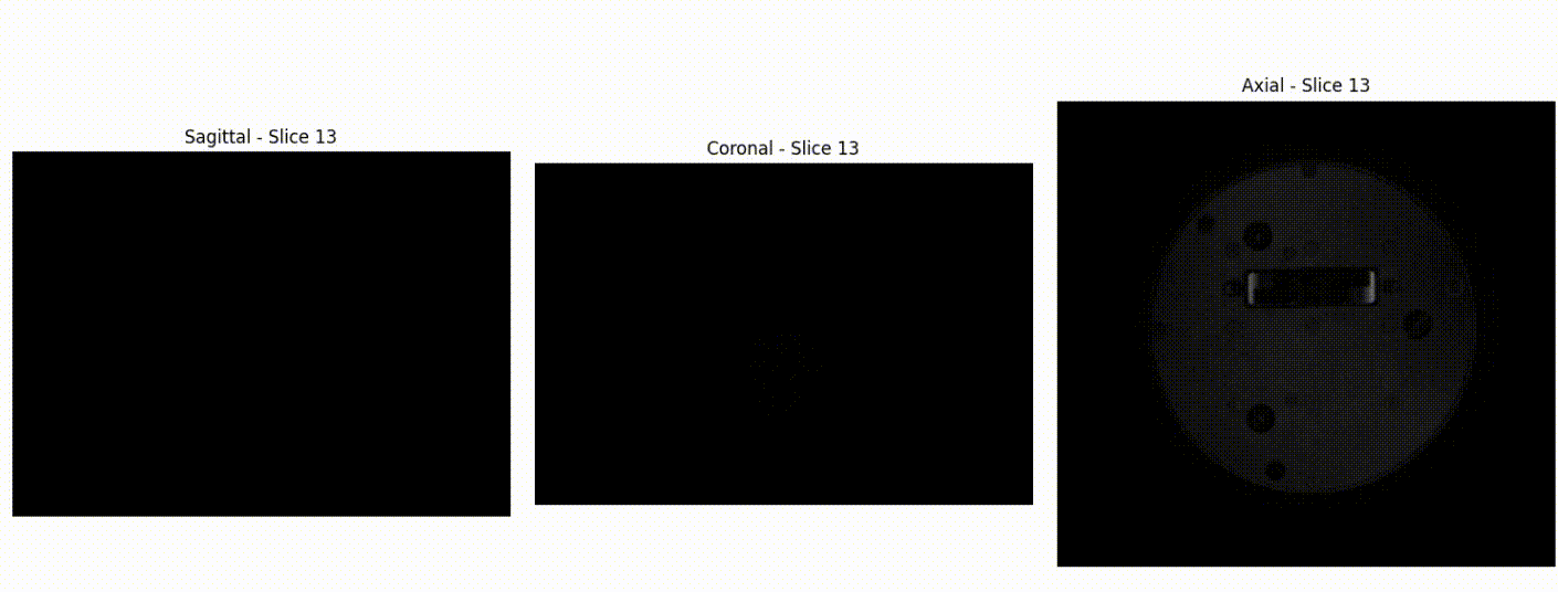 NIST phantom scan acquired at the Technion using the implemented sequence with dedicated reconstruction